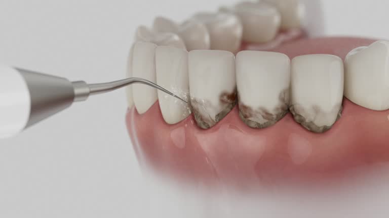 Trusted Tooth Extraction service in Washington, IN - Dentist Open Now